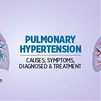 Pulmonary hypertension: Symptoms, Causes and Treatments