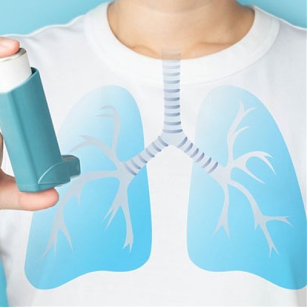 What is Asthma? Causes, Symptoms and Treatment